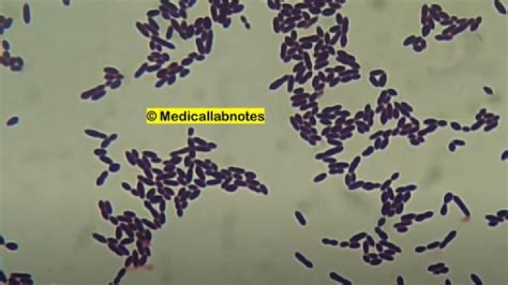 Are Enterococcus durans motile?