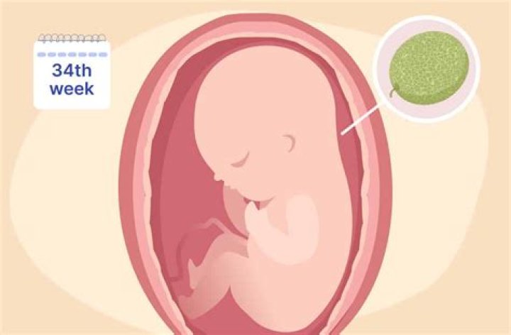 Are mild contractions normal at 34 weeks?