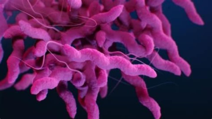 Can Campylobacter cause Pseudoappendicitis?