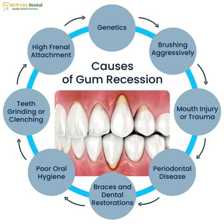 Can gum disease cause teeth to fall out?