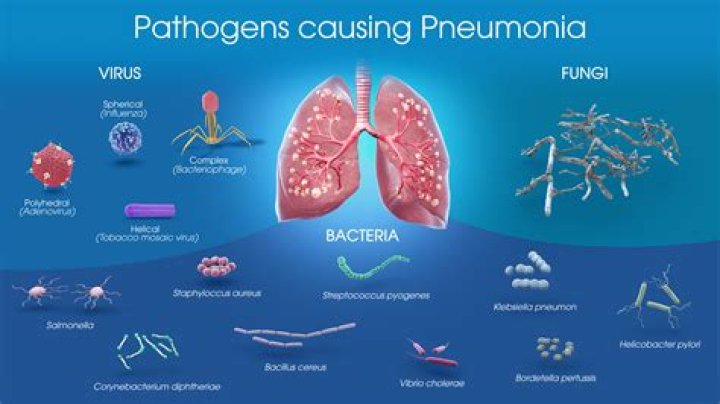Does Pseudomonas aeruginosa cause pneumonia?