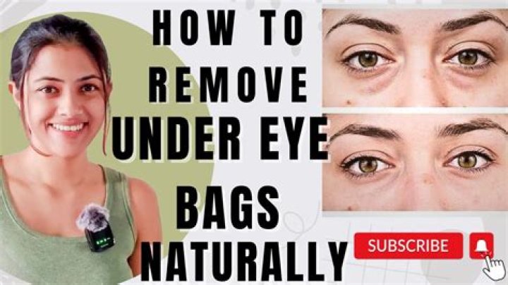 How can I remove my Eyebags?