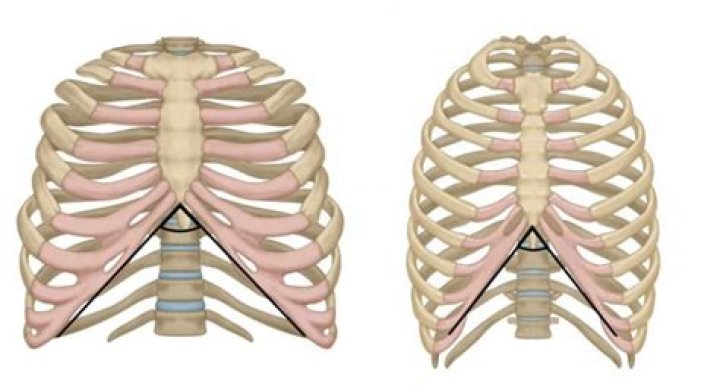 How do I correct a provisional inventorship?