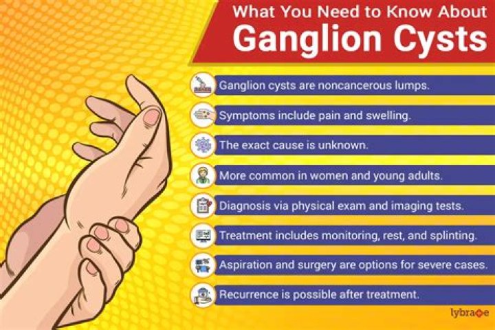 How do you get rid of Gongylonema?