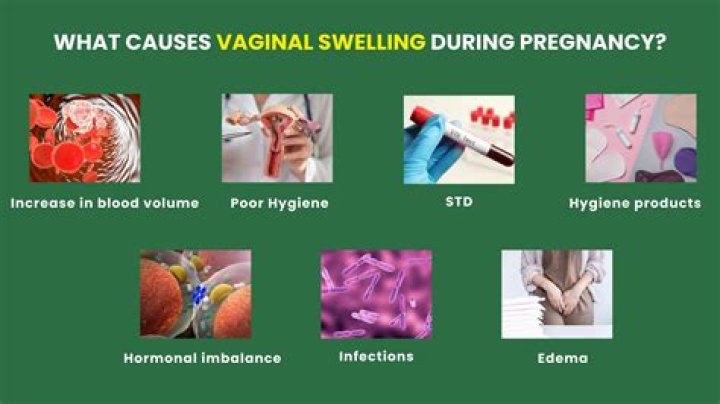 How do you get rid of swollen labia after pregnancy?