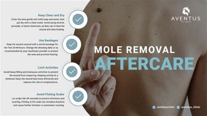How do you tell if a mole removal is infected?