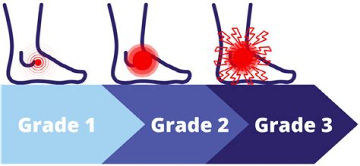 How long does a grade 1 ankle sprain take to heal?