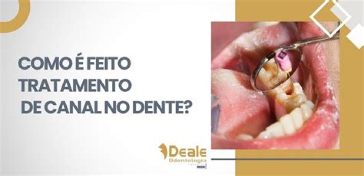 Por que o Labrador precisa de treinamento?