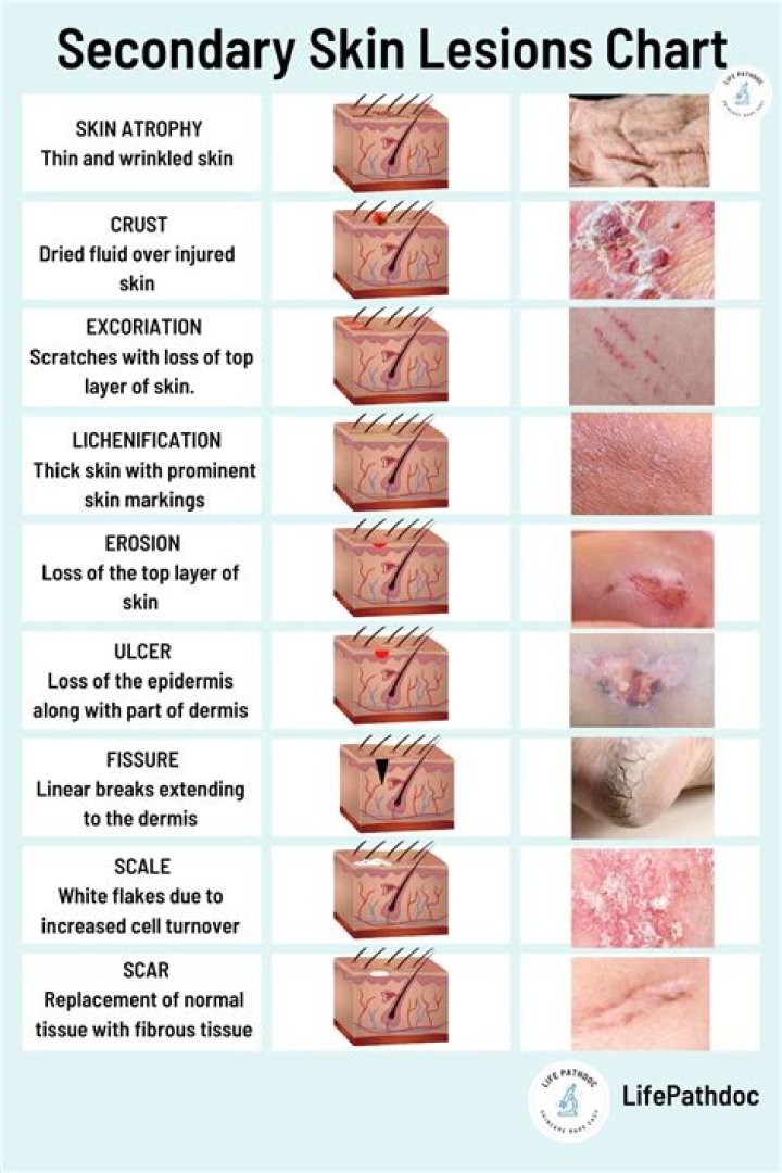 What causes red lesions on skin?