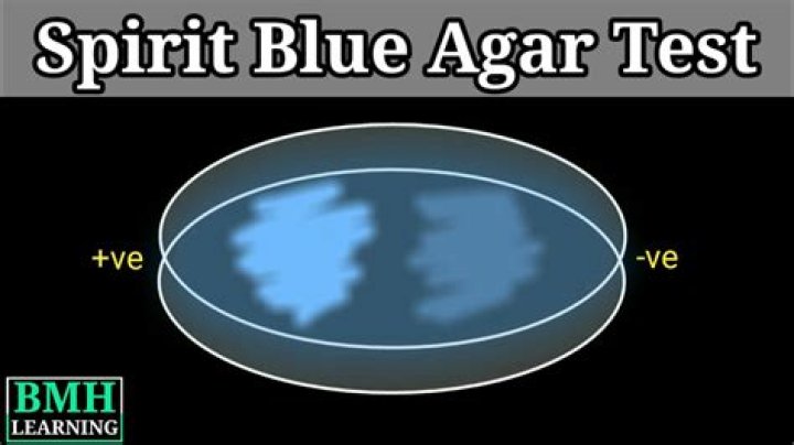 What does spirit blue agar test for?