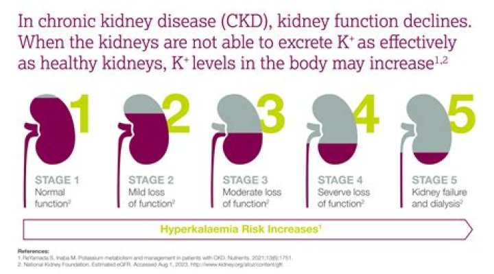What does Stage 5 CKD mean?