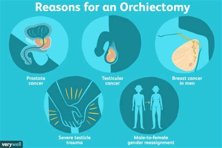 What happens to a man after orchiectomy?