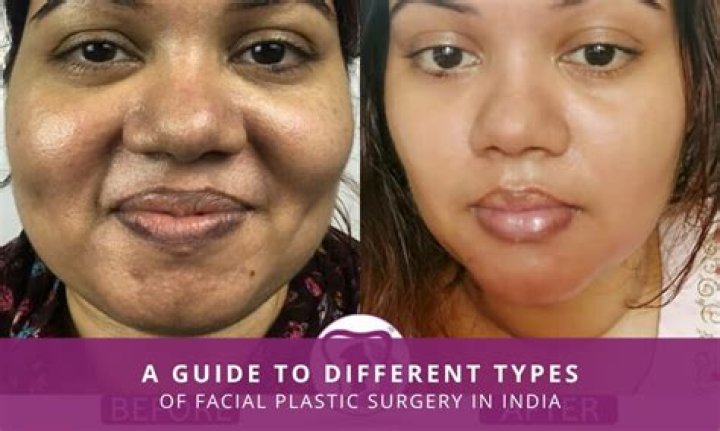 What is plastic surgery on the face called?