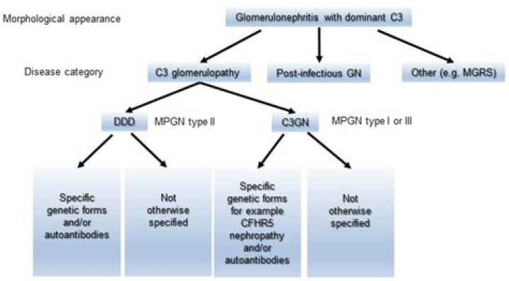 What is proliferative glomerulonephritis with monoclonal IgG deposits?