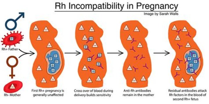 What is Rh phenotyping?