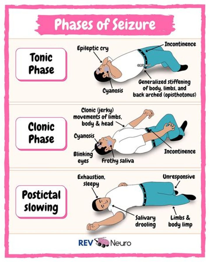 When do you refer to a seizure?